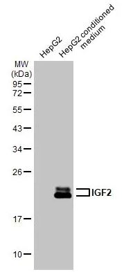 Western blot - Anti-IGF2 antibody [HL1979] (AB308213), expandable thumbnail