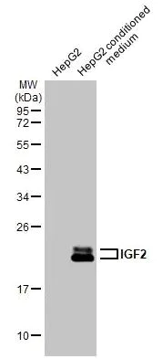 Western blot - Anti-IGF2 antibody [HL1979] (AB308213)