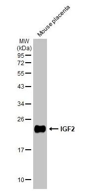 Western blot - Anti-IGF2 antibody [HL1979] (AB308213), expandable thumbnail