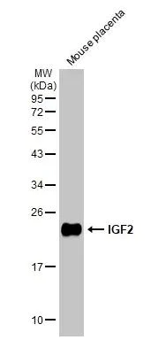 Western blot - Anti-IGF2 antibody [HL1979] (AB308213)