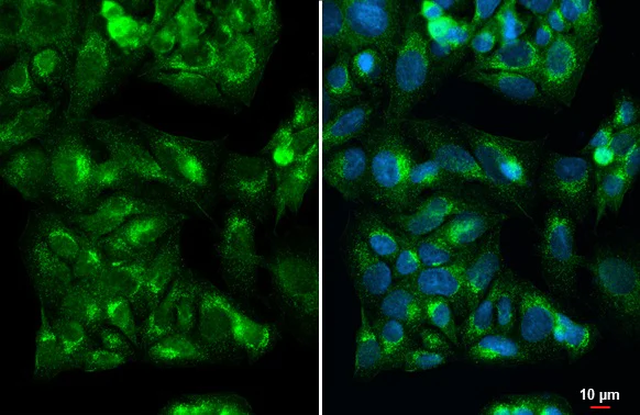 Immunocytochemistry/ Immunofluorescence - Anti-IGF2 antibody [HL1982] (AB308214)