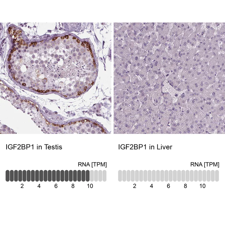 Immunohistochemistry (Formalin/PFA-fixed paraffin-embedded sections) - Anti-IGF2BP1 Antibody (AB327255)