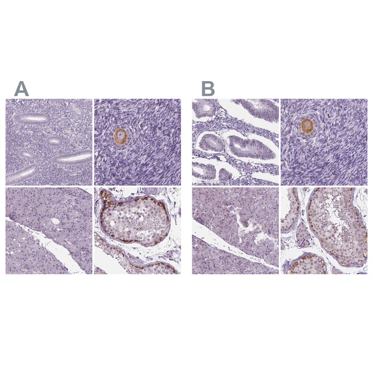 Immunohistochemistry (Formalin/PFA-fixed paraffin-embedded sections) - Anti-IGF2BP1 Antibody (AB327255)