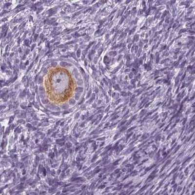 Immunohistochemistry (Formalin/PFA-fixed paraffin-embedded sections) - Anti-IGF2BP1 Antibody (AB327255)