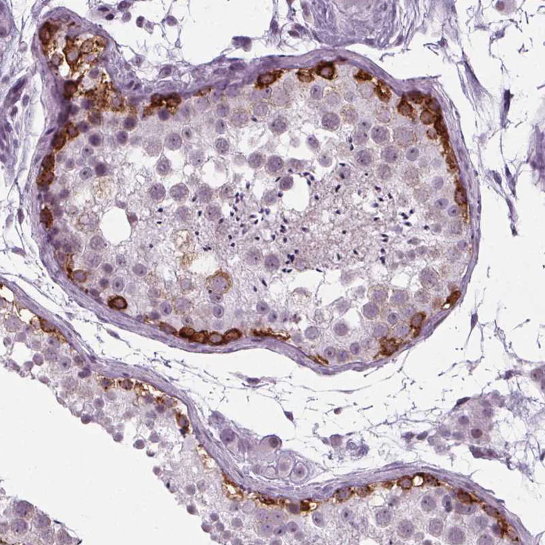 Immunohistochemistry (Formalin/PFA-fixed paraffin-embedded sections) - Anti-IGF2BP1 Antibody (AB327255)