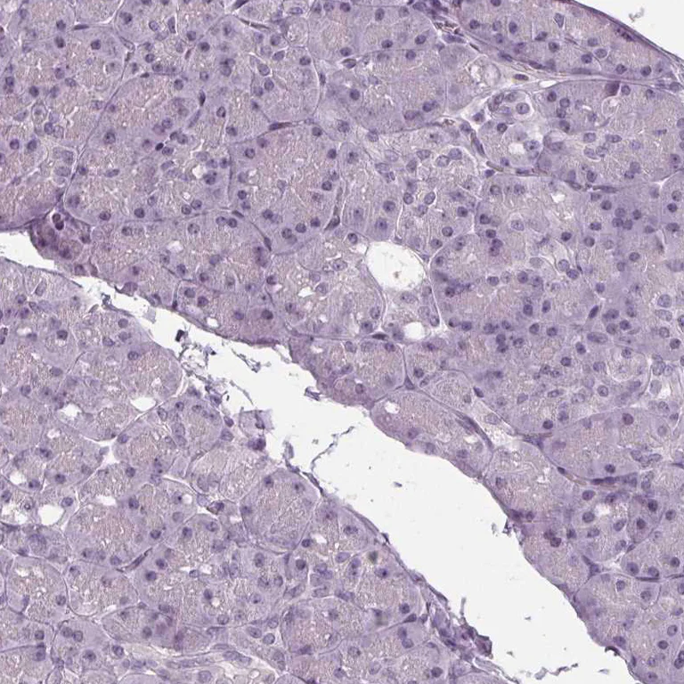 Immunohistochemistry (Formalin/PFA-fixed paraffin-embedded sections) - Anti-IGF2BP1 Antibody (AB327255)
