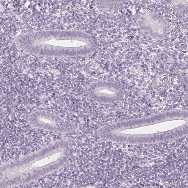 Immunohistochemistry (Formalin/PFA-fixed paraffin-embedded sections) - Anti-IGF2BP1 Antibody (AB327255)