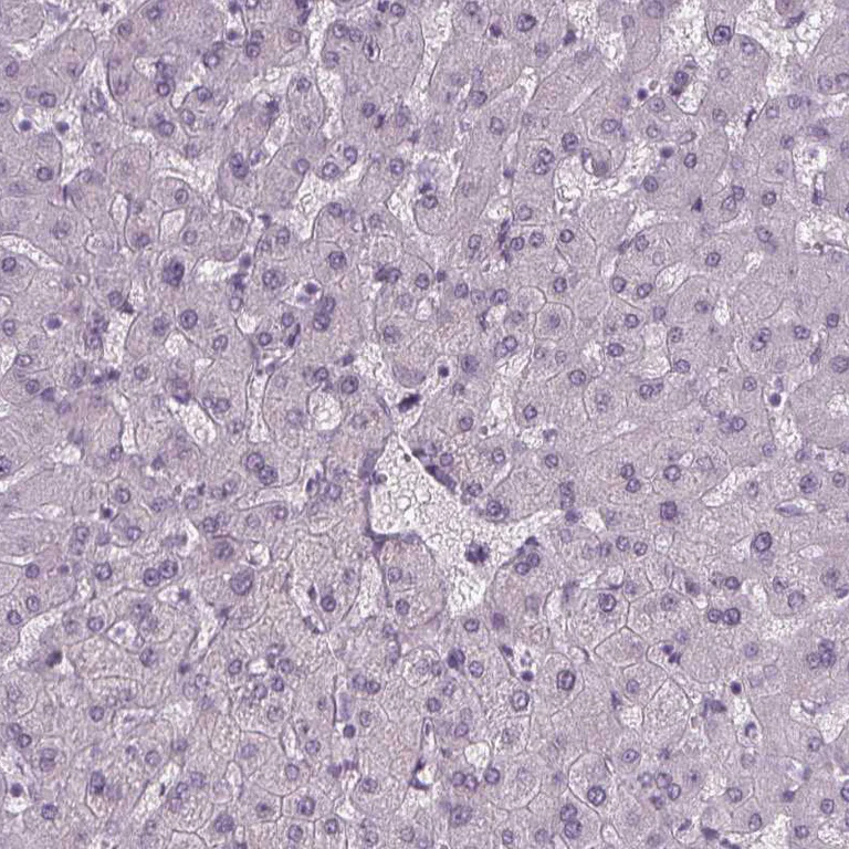 Immunohistochemistry (Formalin/PFA-fixed paraffin-embedded sections) - Anti-IGF2BP1 Antibody (AB327255)