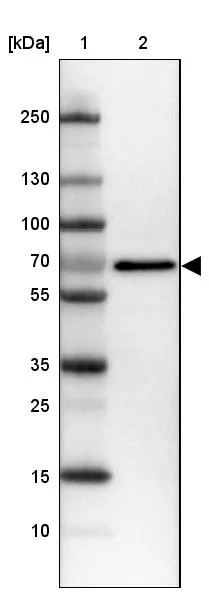 Western blot - Anti-IGF2BP1 Antibody (AB327255)
