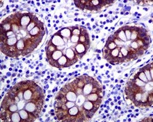 Immunohistochemistry (Formalin/PFA-fixed paraffin-embedded sections) - Anti-IGF2BP1 + IGF2BP2 antibody [EPR6740(2)] (AB129071), expandable thumbnail