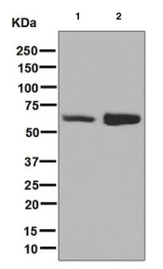 Western blot - Anti-IGF2BP1 + IGF2BP2 antibody [EPR6740(2)] (AB129071), expandable thumbnail
