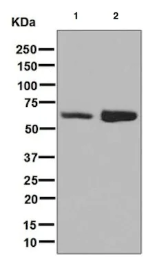 Western blot - Anti-IGF2BP1 + IGF2BP2 antibody [EPR6740(2)] - BSA and Azide free (AB248279)
