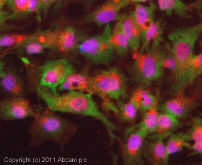 Immunocytochemistry/ Immunofluorescence - Anti-IGF2BP1/IMP1 antibody (AB100999)