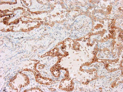 Immunohistochemistry (Formalin/PFA-fixed paraffin-embedded sections) - Anti-IGF2BP1/IMP1 antibody (AB100999)