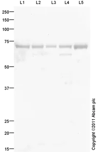 Western blot - Anti-IGF2BP1/IMP1 antibody (AB100999)