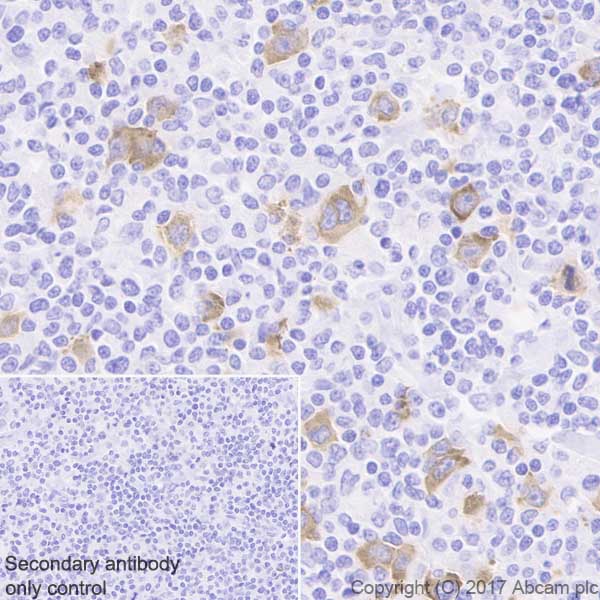 Immunohistochemistry (Formalin/PFA-fixed paraffin-embedded sections) - Anti-IGF2BP1/IMP1 antibody [EPR18791] (AB184305), expandable thumbnail