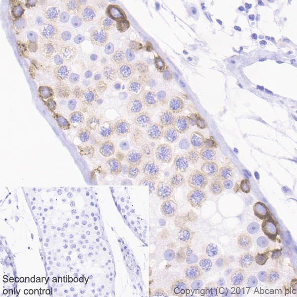 Immunohistochemistry (Formalin/PFA-fixed paraffin-embedded sections) - Anti-IGF2BP1/IMP1 antibody [EPR18791] (ab184305), expandable thumbnail