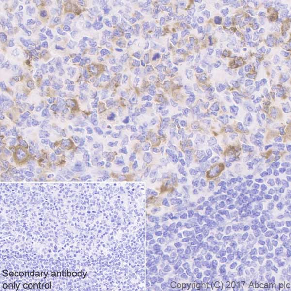 Immunohistochemistry (Formalin/PFA-fixed paraffin-embedded sections) - Anti-IGF2BP1/IMP1 antibody [EPR18791] (AB184305), expandable thumbnail