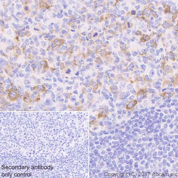 Immunohistochemistry (Formalin/PFA-fixed paraffin-embedded sections) - Anti-IGF2BP1/IMP1 antibody [EPR18791] (AB184305)