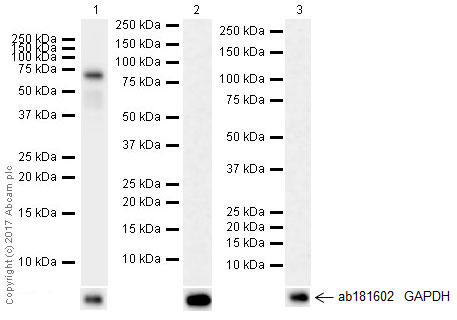 Western blot - Anti-IGF2BP1/IMP1 antibody [EPR18791] (ab184305), expandable thumbnail