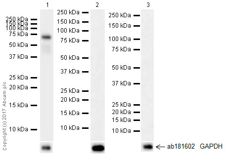 Western blot - Anti-IGF2BP1/IMP1 antibody [EPR18791] (AB184305)