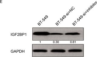 Western blot - Anti-IGF2BP1/IMP1 antibody [EPR18791] (ab184305), expandable thumbnail