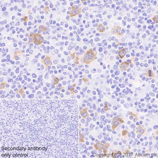 Immunohistochemistry (Formalin/PFA-fixed paraffin-embedded sections) - Anti-IGF2BP1/IMP1 antibody [EPR18791] - BSA and Azide free (AB229700)