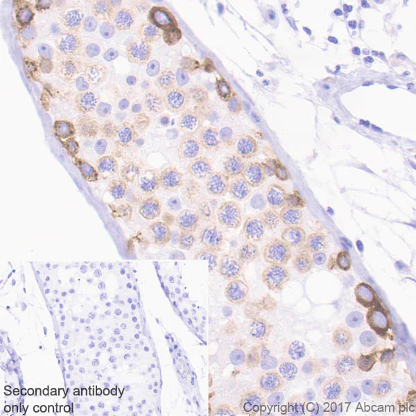 Immunohistochemistry (Formalin/PFA-fixed paraffin-embedded sections) - Anti-IGF2BP1/IMP1 antibody [EPR18791] - BSA and Azide free (AB229700)