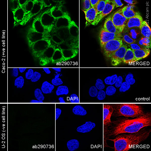 Immunocytochemistry/ Immunofluorescence - Anti-IGF2BP1/IMP1 antibody [EPR26408-18] (AB290736)