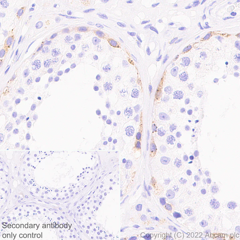 Immunohistochemistry (Formalin/PFA-fixed paraffin-embedded sections) - Anti-IGF2BP1/IMP1 antibody [EPR26408-18] (AB290736)