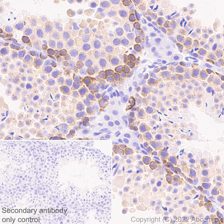 Immunohistochemistry (Formalin/PFA-fixed paraffin-embedded sections) - Anti-IGF2BP1/IMP1 antibody [EPR26408-18] (AB290736)