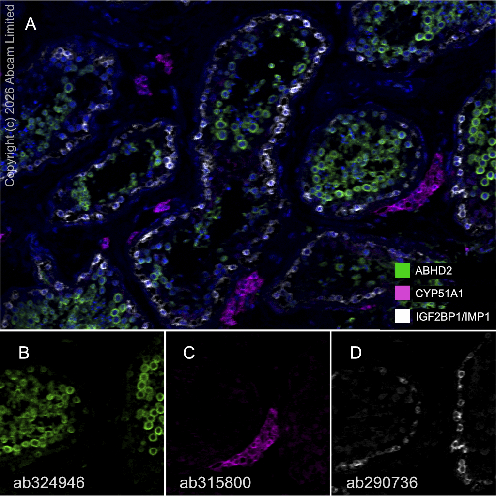 Multiplex immunohistochemistry - Anti-IGF2BP1/IMP1 antibody [EPR26408-18] (AB290736)