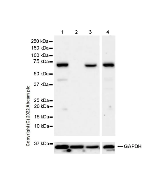 Western blot - Anti-IGF2BP1/IMP1 antibody [EPR26408-18] (AB290736)