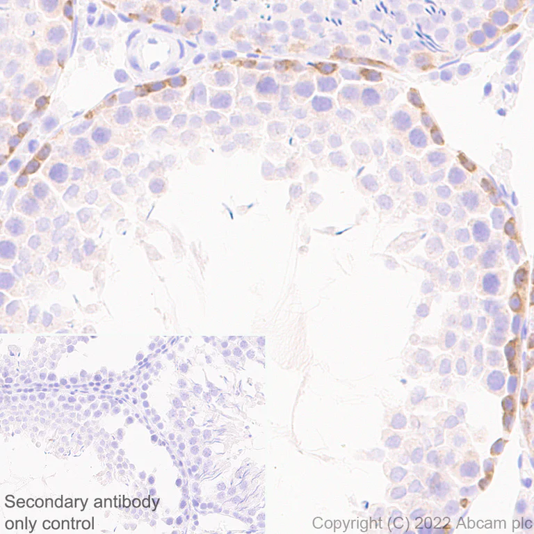 Immunohistochemistry (Formalin/PFA-fixed paraffin-embedded sections) - Anti-IGF2BP1/IMP1 antibody [EPR26408-18] - BSA and Azide free (AB290751)