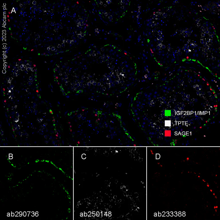 Multiplex immunohistochemistry - Anti-IGF2BP1/IMP1 antibody [EPR26408-18] - BSA and Azide free (AB290751)