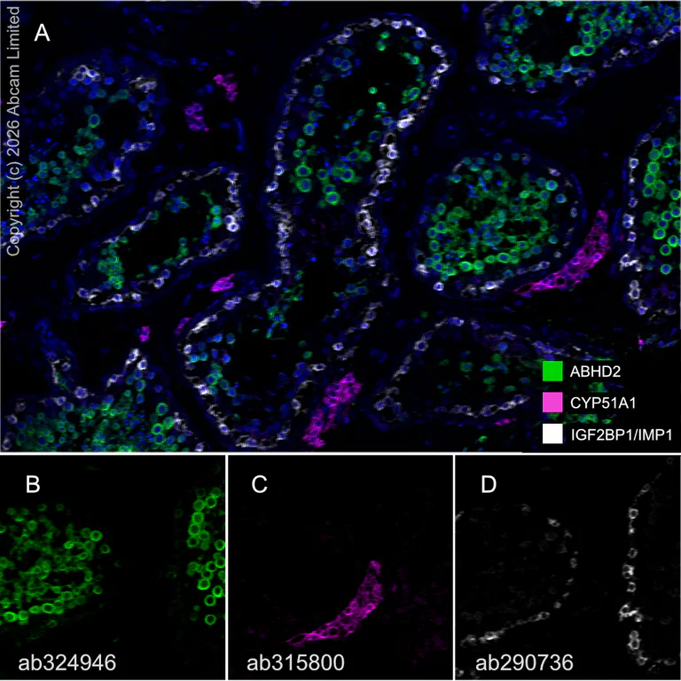 Multiplex immunohistochemistry - Anti-IGF2BP1/IMP1 antibody [EPR26408-18] - BSA and Azide free (AB290751)