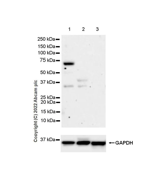 Western blot - Anti-IGF2BP1/IMP1 antibody [EPR26408-18] - BSA and Azide free (AB290751)