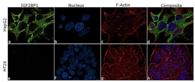 Immunocytochemistry/ Immunofluorescence - Anti-IGF2BP1/IMP1 Antibody [RP23040259] (AB313422), expandable thumbnail