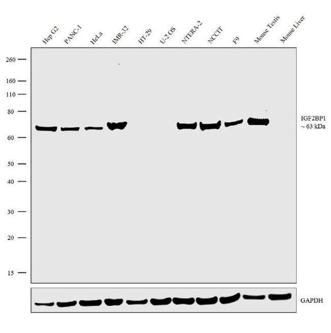 Western blot - Anti-IGF2BP1/IMP1 Antibody [RP23040259] (AB313422), expandable thumbnail