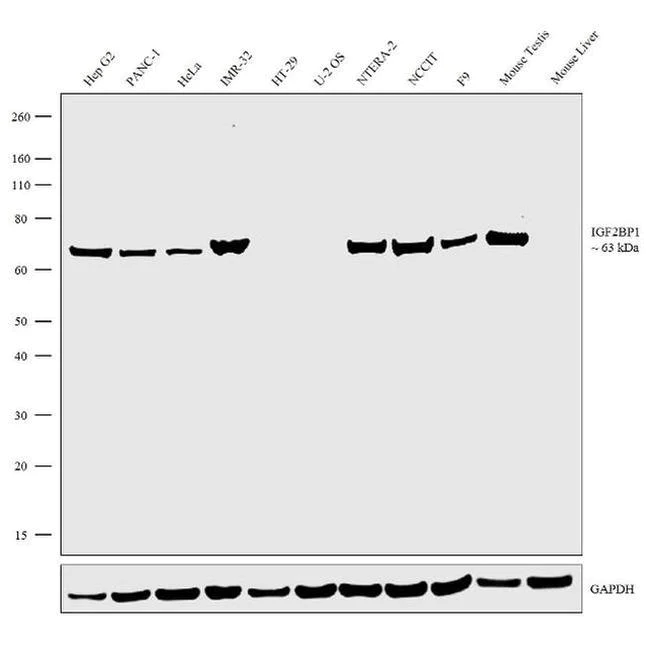 Western blot - Anti-IGF2BP1/IMP1 Antibody [RP23040259] (AB313422)