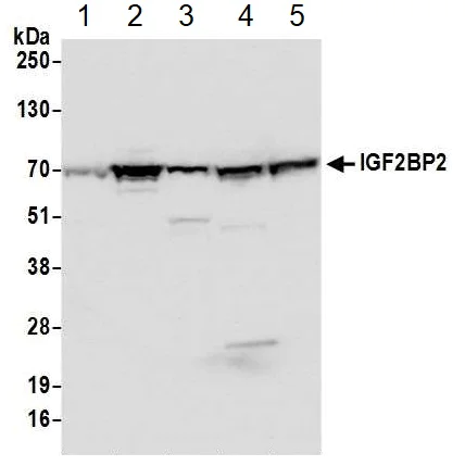 Western blot - Anti-IGF2BP2/IMP-2 antibody [1E3.01E5] (AB128175)