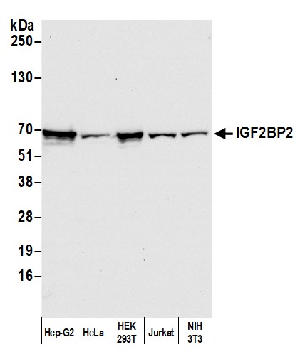 Western blot - Anti-IGF2BP2/IMP-2 antibody [1E3.01E5] (AB128175)