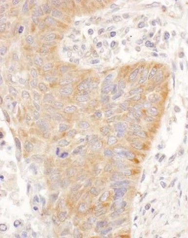 Immunohistochemistry (Formalin/PFA-fixed paraffin-embedded sections) - Anti-IGF2BP2/IMP-2 antibody (AB117809), expandable thumbnail