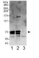 Immunoprecipitation - Anti-IGF2BP2/IMP-2 antibody (AB117809), expandable thumbnail