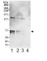Western blot - Anti-IGF2BP2/IMP-2 antibody (AB117809), expandable thumbnail
