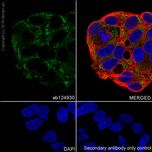 Immunocytochemistry/ Immunofluorescence - Anti-IGF2BP2/IMP-2 antibody [EPR6741(B)] (AB124930), expandable thumbnail