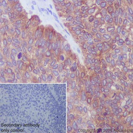 Immunohistochemistry (Formalin/PFA-fixed paraffin-embedded sections) - Anti-IGF2BP2/IMP-2 antibody [EPR6741(B)] (AB124930)