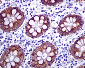 Immunohistochemistry (Formalin/PFA-fixed paraffin-embedded sections) - Anti-IGF2BP2/IMP-2 antibody [EPR6741(B)] (ab124930), expandable thumbnail