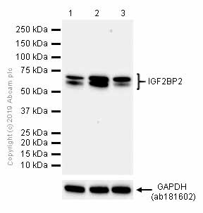 Western blot - Anti-IGF2BP2/IMP-2 antibody [EPR6741(B)] (AB124930), expandable thumbnail