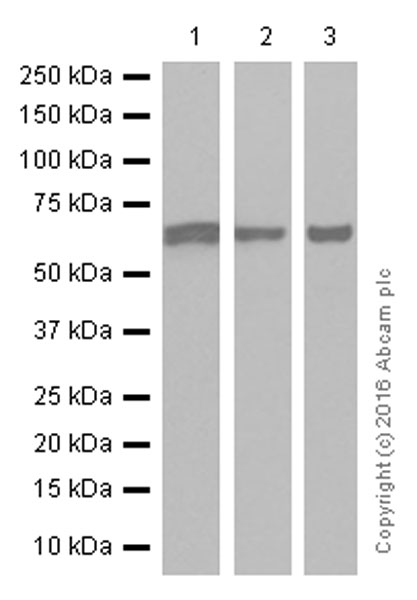 Western blot - Anti-IGF2BP2/IMP-2 antibody [EPR6741(B)] (AB124930), expandable thumbnail